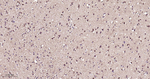 PKC epsilon Antibody in Immunohistochemistry (Paraffin) (IHC (P))