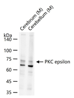 PKC epsilon Antibody in Western Blot (WB)