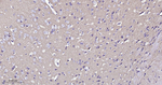 PKC Antibody in Immunohistochemistry (Paraffin) (IHC (P))