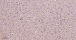 PKC Antibody in Immunohistochemistry (Paraffin) (IHC (P))