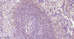 PKC Antibody in Immunohistochemistry (Paraffin) (IHC (P))