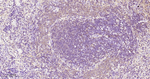 PKC Antibody in Immunohistochemistry (Paraffin) (IHC (P))