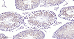 PKC Antibody in Immunohistochemistry (Paraffin) (IHC (P))