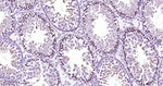 PKC Antibody in Immunohistochemistry (Paraffin) (IHC (P))