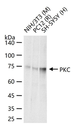 PKC Antibody in Western Blot (WB)