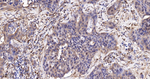 RelB Recombinant Rabbit Monoclonal Antibody (14D9)