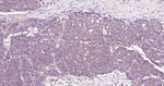 ROCK1 Antibody in Immunohistochemistry (Paraffin) (IHC (P))