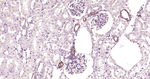 ROCK1 Antibody in Immunohistochemistry (Paraffin) (IHC (P))