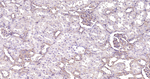 ROCK1 Antibody in Immunohistochemistry (Paraffin) (IHC (P))
