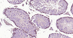 ROCK1 Antibody in Immunohistochemistry (Paraffin) (IHC (P))