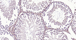 ROCK1 Antibody in Immunohistochemistry (Paraffin) (IHC (P))