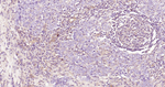 ROCK1 Recombinant Rabbit Monoclonal Antibody (19F9)
