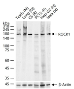 ROCK1 Antibody in Western Blot (WB)