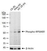 Phospho-p70 S6 Kinase (Thr421, Ser424) Recombinant Rabbit Monoclonal Antibody (18F4)