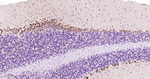 p70 S6 Kinase Antibody in Immunohistochemistry (Paraffin) (IHC (P))