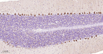 p70 S6 Kinase Antibody in Immunohistochemistry (Paraffin) (IHC (P))