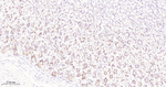 p70 S6 Kinase Antibody in Immunohistochemistry (Paraffin) (IHC (P))