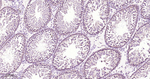 p70 S6 Kinase Antibody in Immunohistochemistry (Paraffin) (IHC (P))