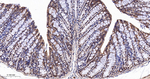 RPS6KB2 Antibody in Immunohistochemistry (Paraffin) (IHC (P))