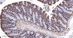 RPS6KB2 Antibody in Immunohistochemistry (Paraffin) (IHC (P))