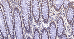 RPS6KB2 Antibody in Immunohistochemistry (Paraffin) (IHC (P))
