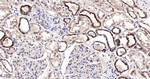 RPS6KB2 Antibody in Immunohistochemistry (Paraffin) (IHC (P))