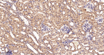 RPS6KB2 Antibody in Immunohistochemistry (Paraffin) (IHC (P))