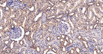 RPS6KB2 Antibody in Immunohistochemistry (Paraffin) (IHC (P))