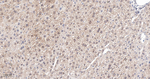 RPS6KB2 Antibody in Immunohistochemistry (Paraffin) (IHC (P))