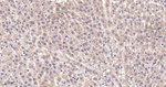 RPS6KB2 Antibody in Immunohistochemistry (Paraffin) (IHC (P))