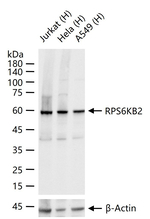 RPS6KB2 Antibody in Western Blot (WB)
