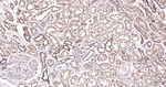 EDG3 Antibody in Immunohistochemistry (Paraffin) (IHC (P))