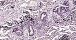 EDG3 Antibody in Immunohistochemistry (Paraffin) (IHC (P))