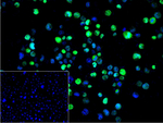 SATB2 Recombinant Rabbit Monoclonal Antibody (9D1)