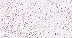 SATB2 Antibody in Immunohistochemistry (Paraffin) (IHC (P))
