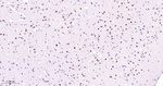 SATB2 Antibody in Immunohistochemistry (Paraffin) (IHC (P))