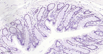 SATB2 Antibody in Immunohistochemistry (Paraffin) (IHC (P))