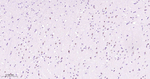 SATB2 Antibody in Immunohistochemistry (Paraffin) (IHC (P))
