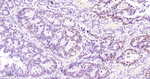 SATB2 Antibody in Immunohistochemistry (Paraffin) (IHC (P))