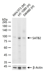 SATB2 Antibody in Western Blot (WB)
