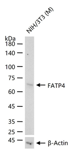 SLC27A4 Recombinant Rabbit Monoclonal Antibody (20C7)