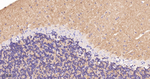 SNAP25 Recombinant Rabbit Monoclonal Antibody (8E5)