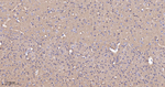 SNAP25 Antibody in Immunohistochemistry (Paraffin) (IHC (P))