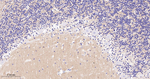 SNAP25 Antibody in Immunohistochemistry (Paraffin) (IHC (P))