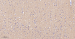 SNAP25 Antibody in Immunohistochemistry (Paraffin) (IHC (P))