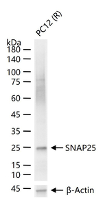 SNAP25 Antibody in Western Blot (WB)