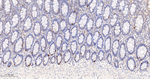 TIMP1 Antibody in Immunohistochemistry (Paraffin) (IHC (P))