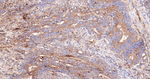 TIMP1 Antibody in Immunohistochemistry (Paraffin) (IHC (P))