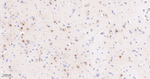 TIMP1 Antibody in Immunohistochemistry (Paraffin) (IHC (P))
