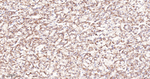 TIMP1 Antibody in Immunohistochemistry (Paraffin) (IHC (P))